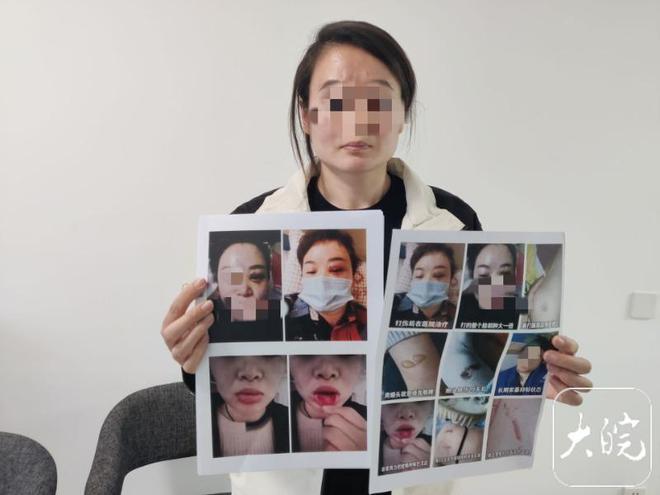 郑州一女子遭丈夫长期家暴，丈夫曾逼其喝尿，相关情节一一曝出