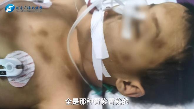 男童被“后妈”虐死案今开庭，生母讲述男童被虐过程，令网友震惊