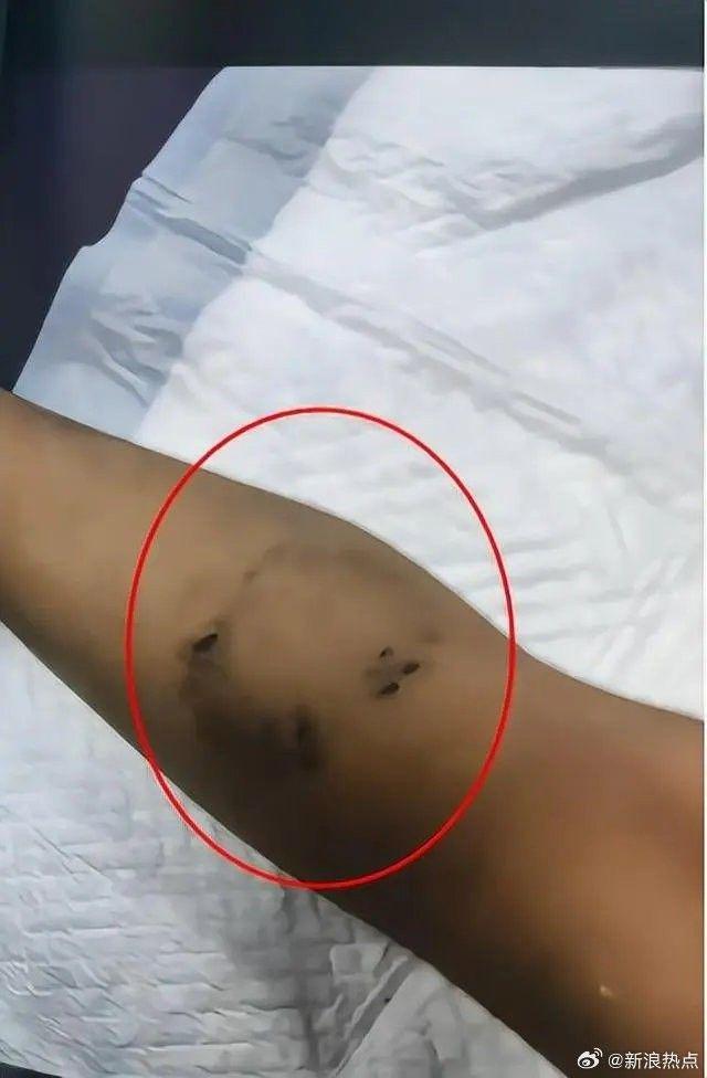 男童被“后妈”虐死案今开庭，生母讲述男童被虐过程，令网友震惊