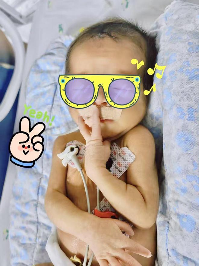 高龄产妇两次减胎并延迟分娩，诞下健康宝宝！提醒：多胎妊娠早产概率高